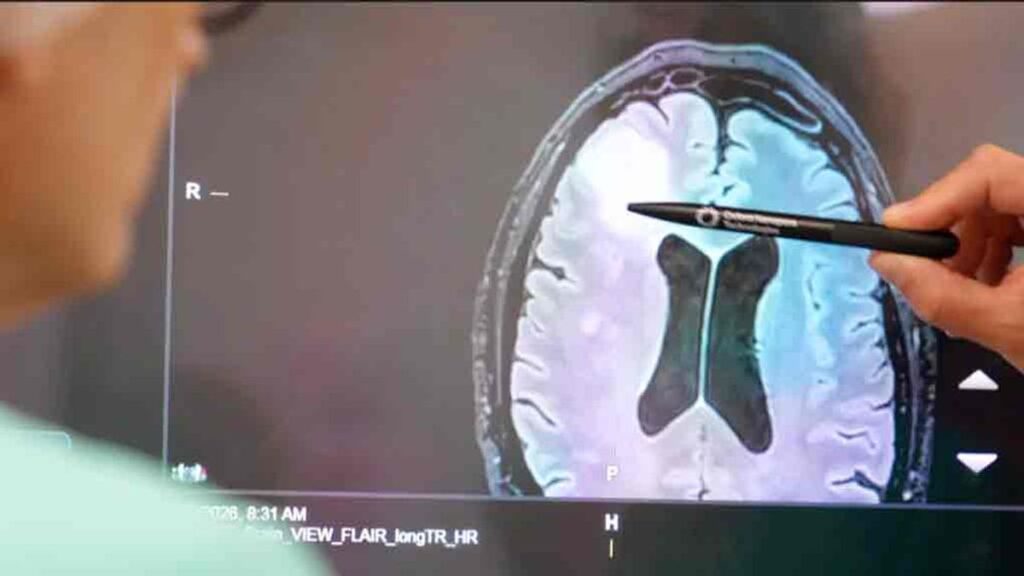 প্রায় দুই মাসের বদলে মাত্র দুই ঘণ্টায় শনাক্ত হবে মস্তিষ্কের টিউমার 6hdg