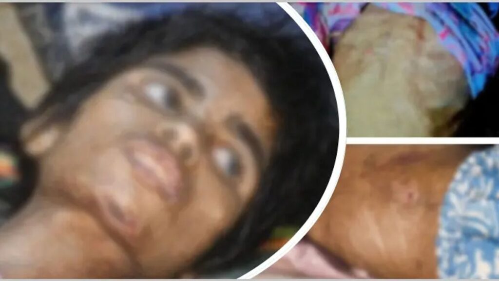 বাথরুমে বন্দি রাখা হতো শিশু তানিয়াকে, নির্যাতনে শরীরে পচন torture-20260914101342